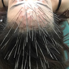 精神疾患の対するルート治療中の画像